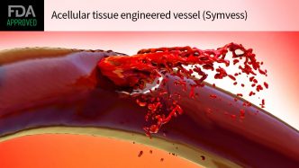 FDA OKs Bioengineered Vessel to Reduce Limb Amputations After Vascular Trauma